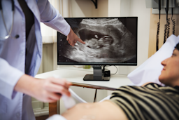Pregnancy ultrasound podcast image